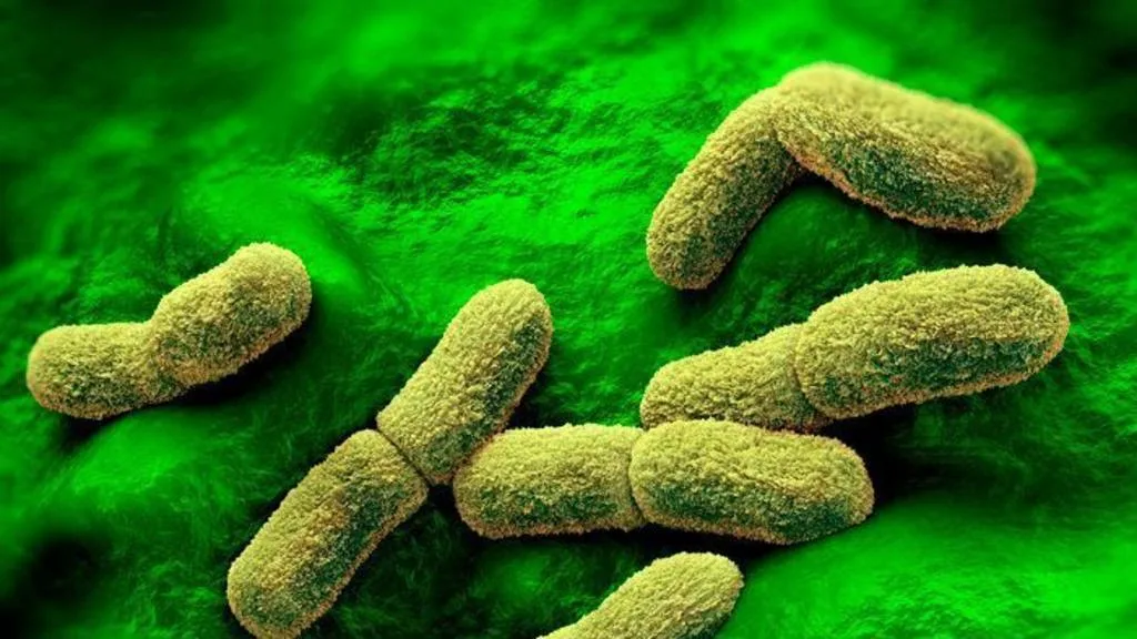 Russian plague research institute in Irkutsk under close monitoring after a technician's death
