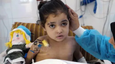 الطفلة راسيل البلاوي خلال تلقيها العلاج في غزة بعد إصابتها في غارة جوية